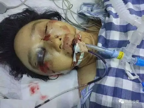 突发|绍兴一女士遇车祸重伤,情况紧急,请大家帮忙找家属!