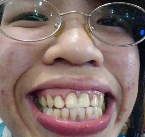 世界最丑的女人