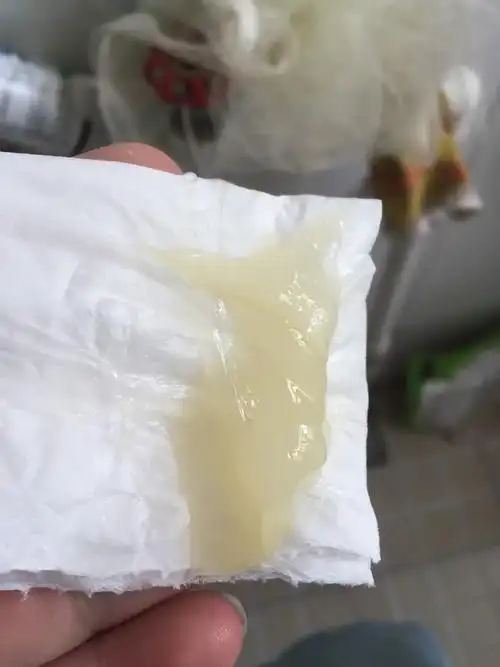 刨腹产后五个月下面突然下来白色胶状物