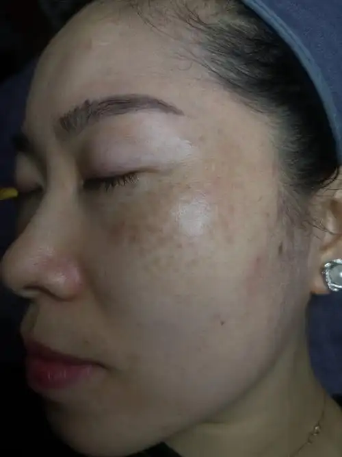 脸上长斑点怎么办?祛斑有方法,不试后悔_百科-8s新商盟