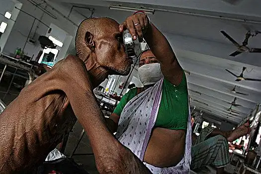 困苦,肺结核,诊所,中心,贫民窟,加尔各答,西孟加拉,印度亲属,病人