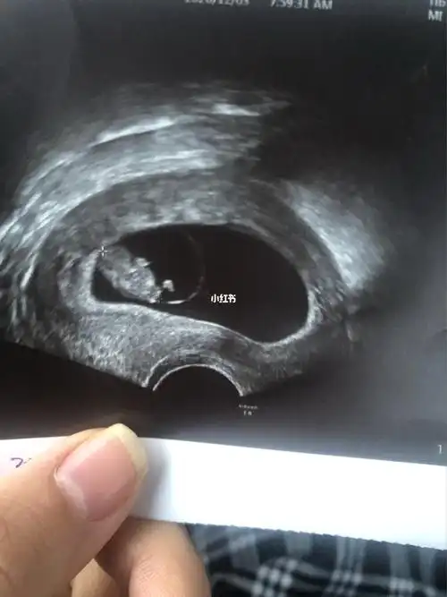 九周了,第一次看到你