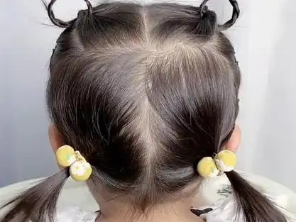 六一给女鹅编个小熊耳朵发型吧,简单又可爱的#短发宝宝编发 #一岁宝宝