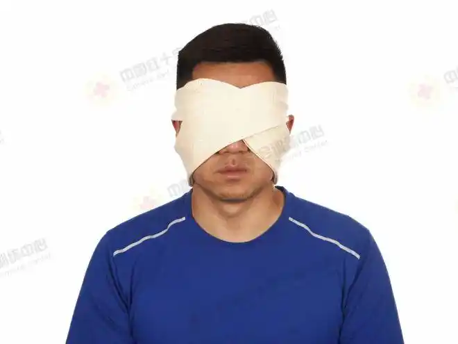 急救知识|现场包扎技术之三角巾双眼包扎|敷料|绷带_网易订阅