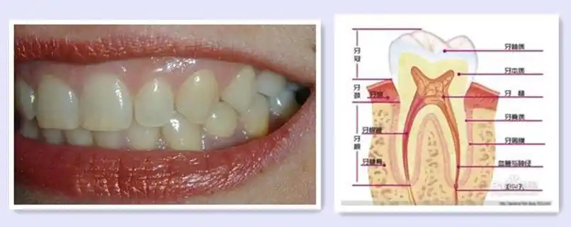 想让牙齿变白,到底有哪些方法?