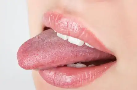 的话,或者是看上去哥哥呆呆的时候,此外,唐有观察舌头的颜色的时候