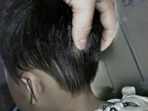 我儿子后脑勺两边不一样平怎么回事啊?