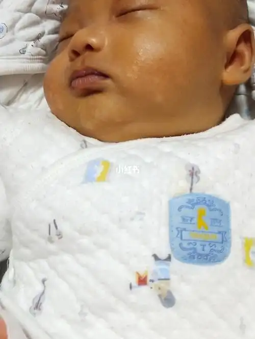 宝宝黄疸还是退不了.