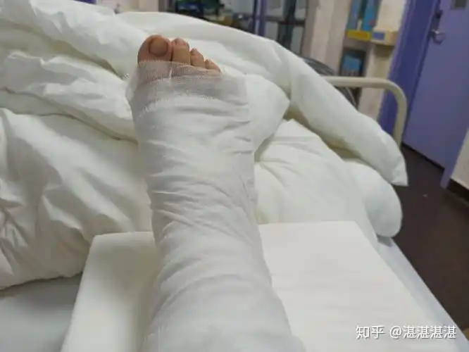 记录右脚第五跖骨骨折的日子