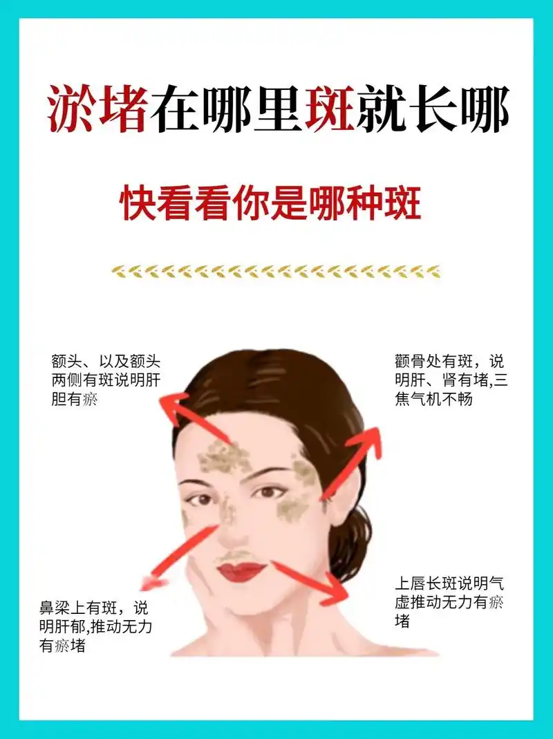 95.脸上的斑,对应内在的淤 - 抖音