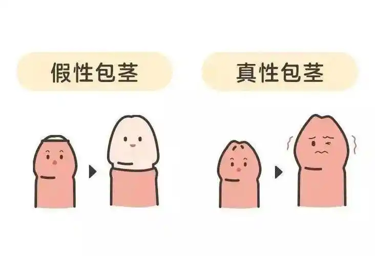 宝宝私处的异常情况千万别大意男宝宝有3种女宝宝有6种