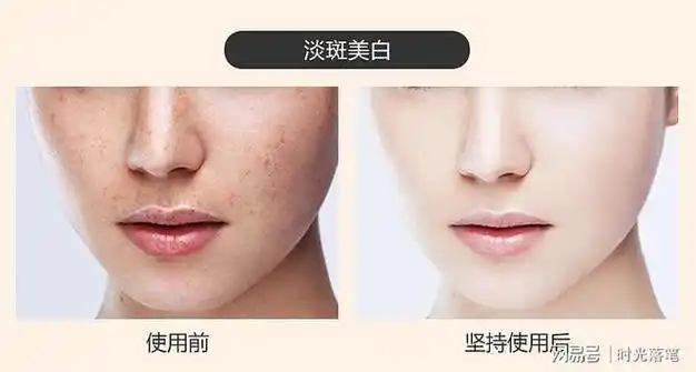 淡斑祛斑效果排名第一,这几款,平价国产好用|美白|精华液|祛斑霜|爽肤