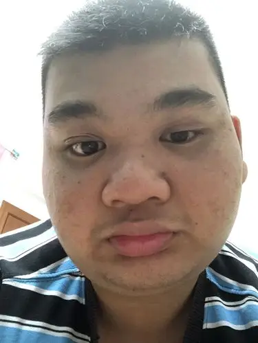 我有没有黑眼圈