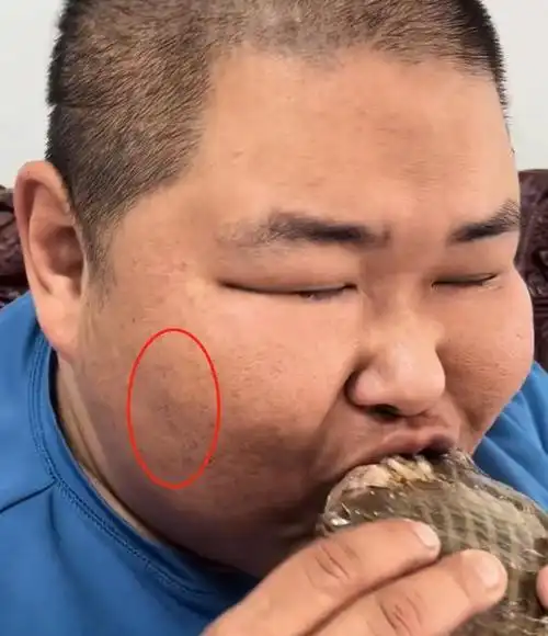 450斤男吃播甲麻甲辣面部出现黑斑网友泡泡龙喊你回家