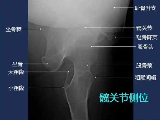 常规x线影像解剖大全