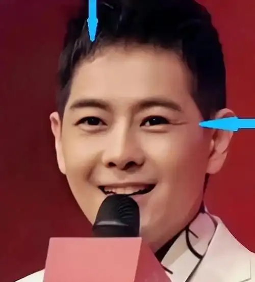 林志颖术后素颜生图曝光,和欧弟吃饭撞脸李幼斌,帽不离身疑自卑