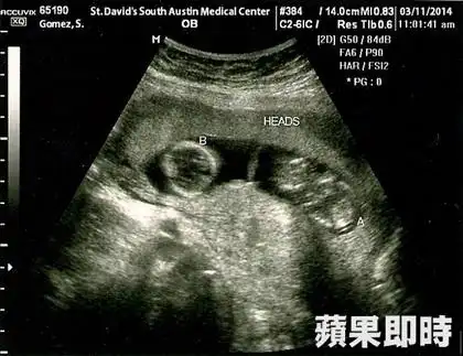 网易娱乐3月20日报道 据国外媒体报道,加拿大偶像贾斯汀比伯(justin