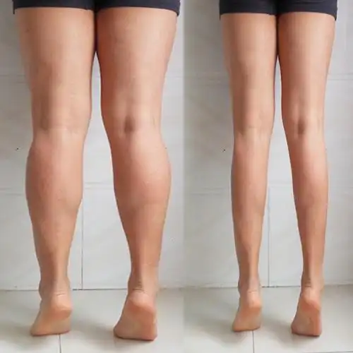 紧肤瘦腿精油快速瘦大腿小腿肌肉减肚子腰手臂按摩刮痧神器顽固型