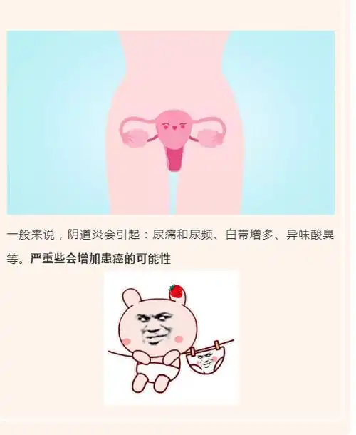 23岁女子外阴癌前病变她的坏习惯为所有人敲响警钟