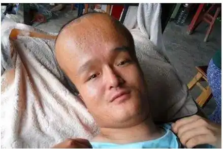 那些被"三鹿奶粉"毒害的大头娃娃,如今怎么样了?现状令人唏嘘