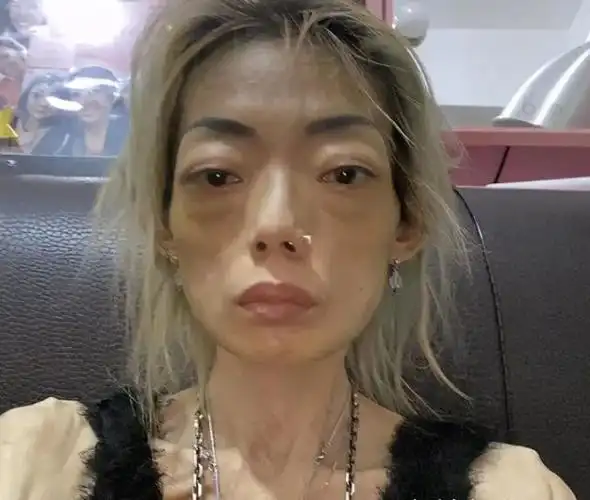 被豪门抛弃,瘦到皮包骨,伍智恒嫁入豪门的8年经历了什么