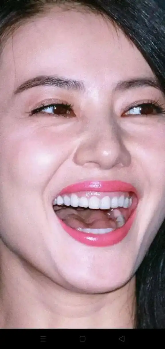 高圆圆这牙是镶的吧!