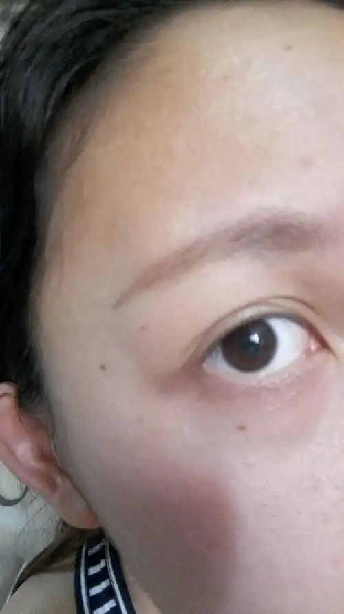 奸门有痣是一种怎样的体验?