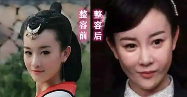 娱乐圈的"整容脸",看看他们上镜有离谱,硅胶感十足像发面馒头