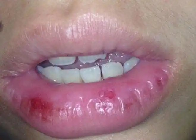 口臭,嘴烂,全身痛该怎么办?一物降一物,这些"营养素"补起来_身体