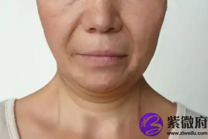 嘴角往下垂的男人运势怎样