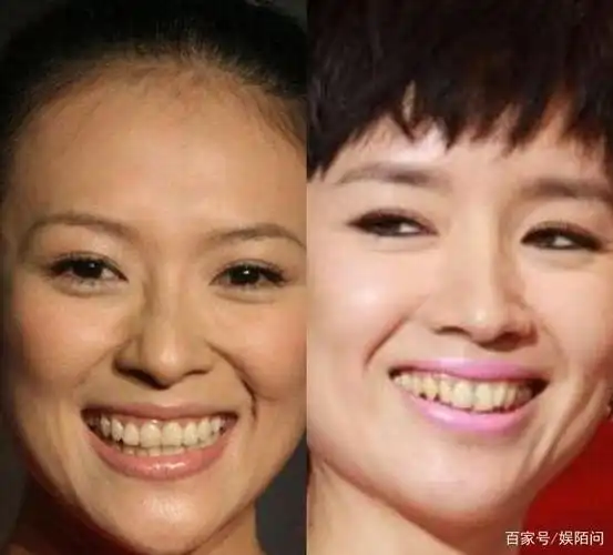 景甜的"钻石牙"为什么火了!李佳琦:她曾因牙黄出名上热搜