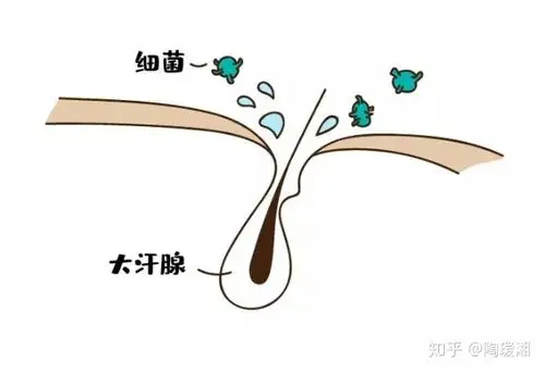 作为有狐臭的女生,是怎样的体验?