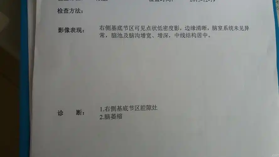 左侧胸腔积液原因待查