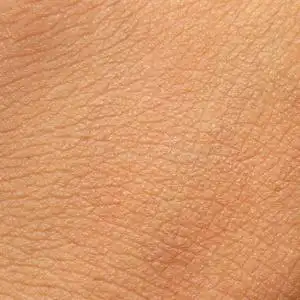 粗糙的皮肤图片-粗糙的皮肤素材-粗糙的皮肤插画-摄图新视界