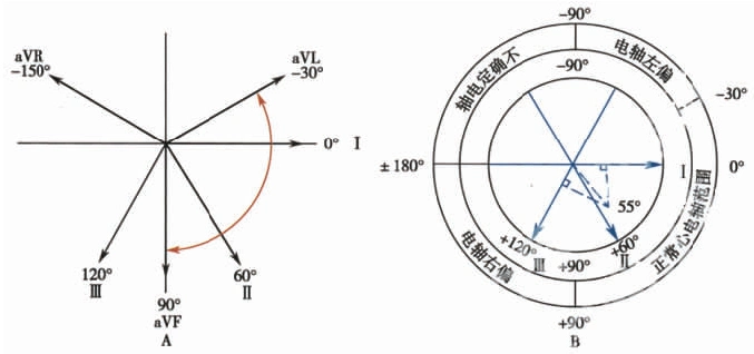 心电轴的测量方法,你掌握了几种?|心电3分钟_心电轴_医脉通