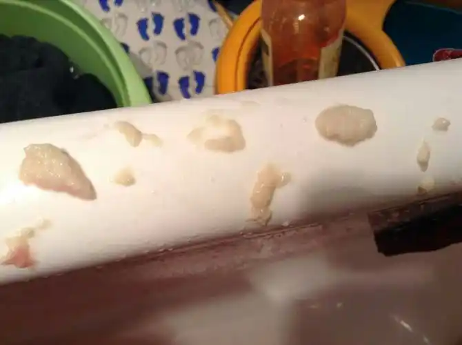 前一周 阴道内总瘙痒有异味有白黄粘稠性液体 四五天后月经来了才没有