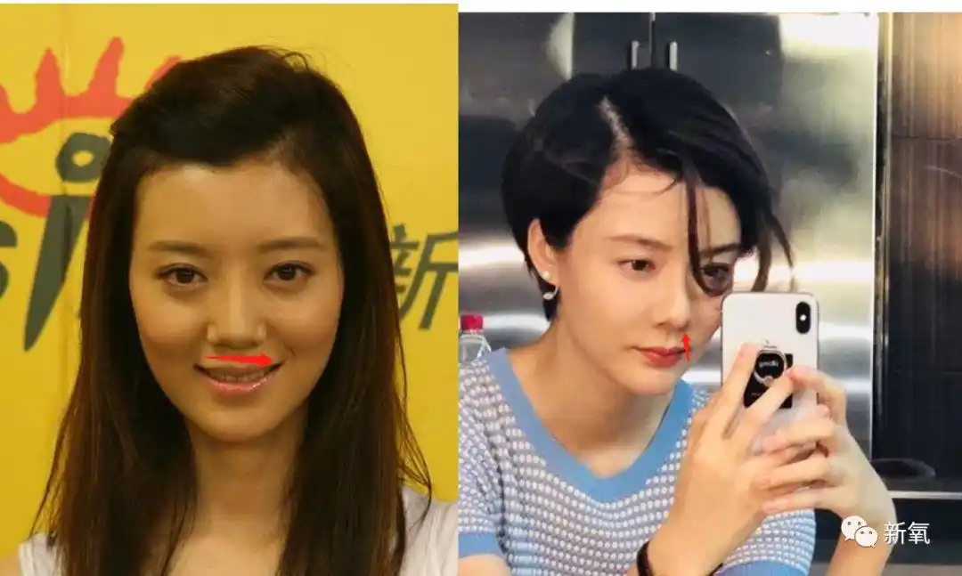 这是我见过最敢的女星,猪鼻子还能演美女?|假体|鼻头|车晓_新浪新闻