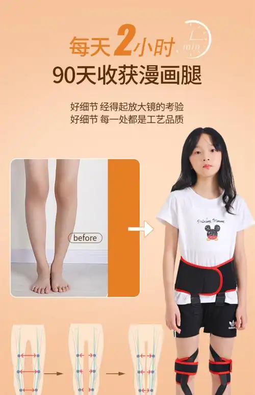 儿童内八矫正器脚内旋外八字矫正带xo学生腿型矫正神器直腿 加强版