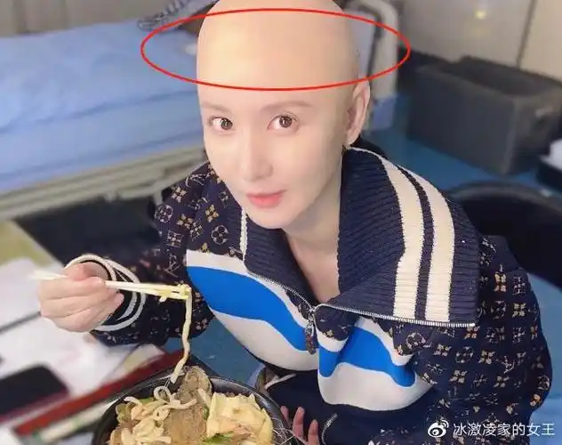 张萌光头造型罕曝光脑门锃亮头皮发黄脸变长身上外套价值不菲