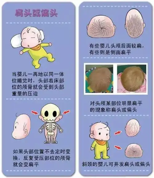 宝宝头型塑造方法