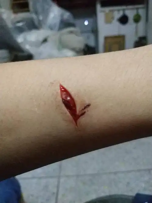 那个这个伤口严重吗