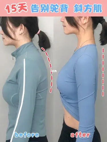 15天快速拥有少女背矫正圆肩驼背