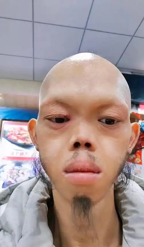 不是他的颜值有多帅,而是过于有特色,与常人的区别非常大:光头,几乎没