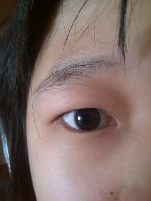 戴眼镜眼睛变成这样怎么拯救啊,求有效的方法昂,手术什么的死开.