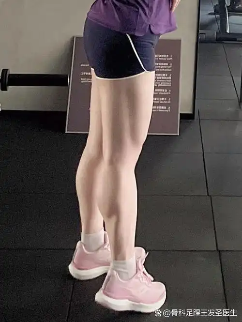 睡前瘦小腿的八个动作