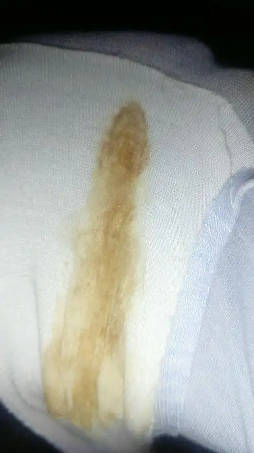 顽强!怀孕白带褐色"口是心非"-第2张图片-影驰网