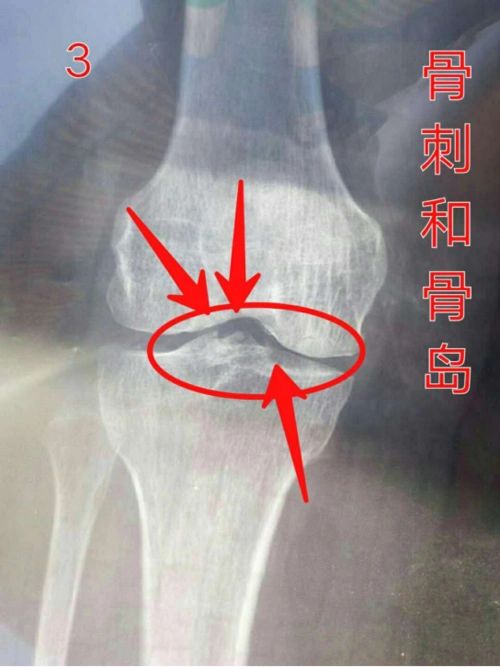 20190412如何看x光片