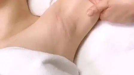 腋下淋巴排毒手法2