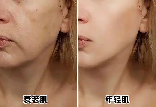 慢慢变成所谓的 "黄脸婆"