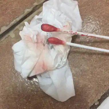 我2月份自然流产一次,这个月月经推迟3天测试又没有怀孕,今天出血量